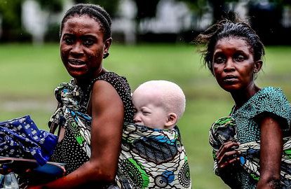 albinos-tanzanie-2_5300849.jpg