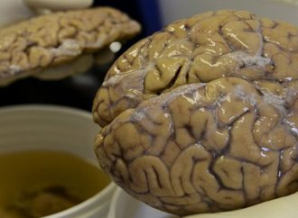 un-scientifique-manipule-un-cerveau-a-medellin_1557246_667x333.jpg