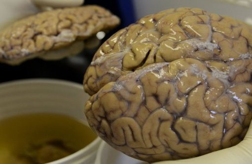 un-scientifique-manipule-un-cerveau-a-medellin_1557246_667x333.jpg