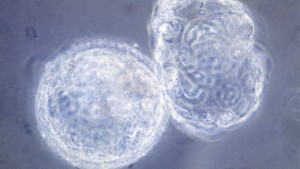 Cellules d'un embryon humain en phase de division (blastomère, 6 jours après la fertilisation). Microscopie optique.